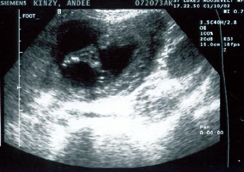 Zia In the Belly picture